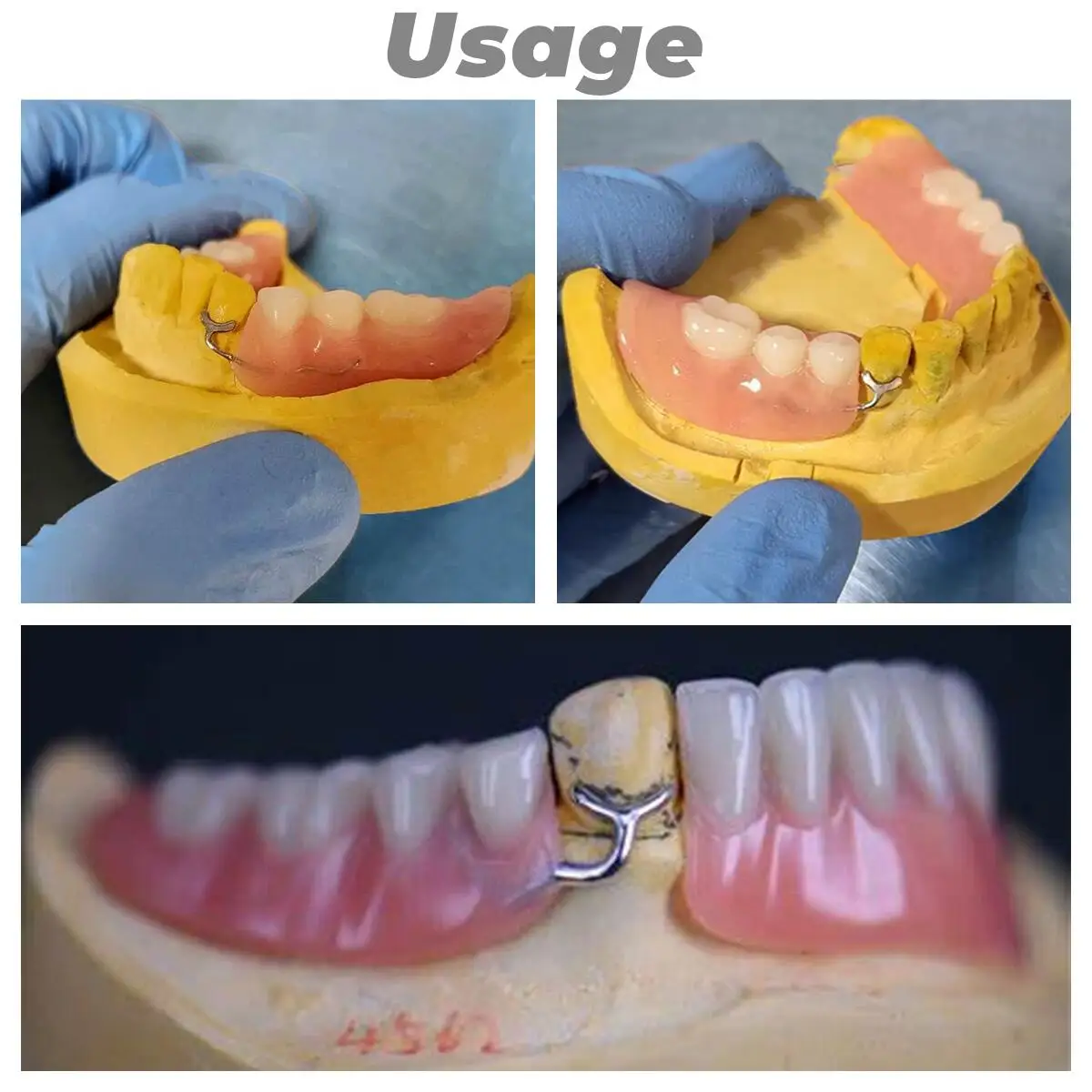 Dental J Clasp Ball Retainer Orthodontic 0.8/0.9/1.0 Oblique Bar Y-Type ScheuTeeth Position Hold