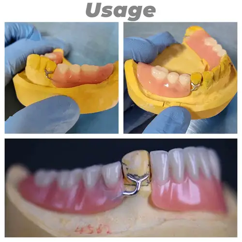 Imagen 2 del producto Retenedor de bola con cierre Dental J, ortodoncia, barra oblicua de 0,8/0,9/1,0, sujeción de posición de dientes tipo Y
