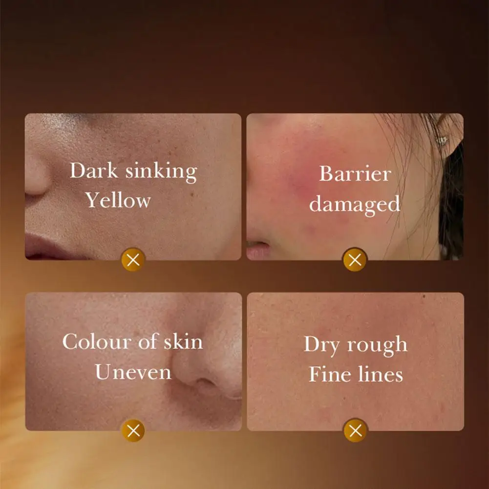 SADOER 70% مصل إصلاح جوهر الأرز برايت فير سكين نياسيناميد وسيراميد، يغذي البشرة الحساسة، العناية بالبشرة بالأرز الكوري