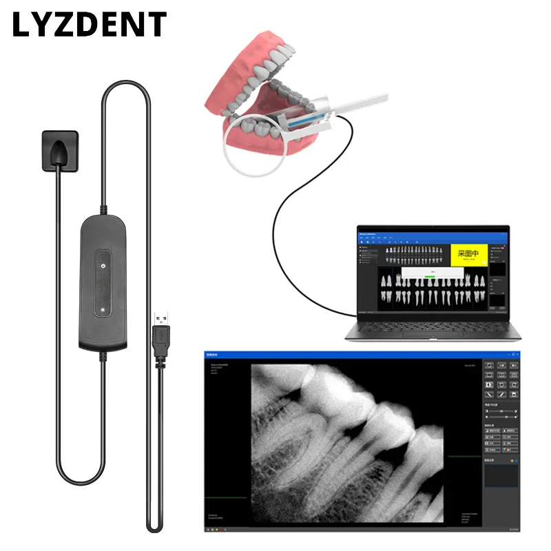 Dentist Digital camera Dental Dentistry Sensor X-Ray High-Frequency Rx Digital Intraoral Digital System H D Image Radiovisografo