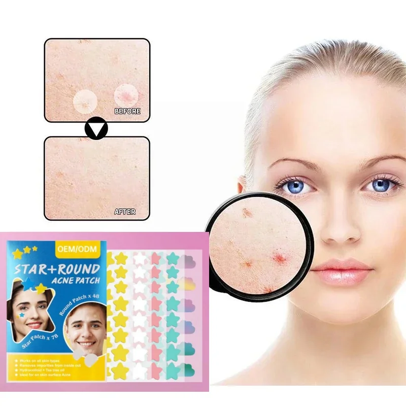 Kleurrijke ster puistjespleisters Leuke hydrocolloïde acne-stickers Onzichtbare gezichtsvlekbehandeling voor oogverzorging Acne-stickers