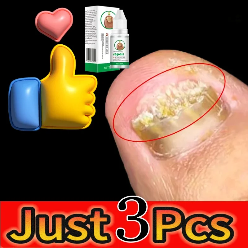 Nail Fungal Treatment Oil Foot Toe Nail Fungus Removal Essential Cream Anti Infection Onychomycosis Paronychia Repair Gel