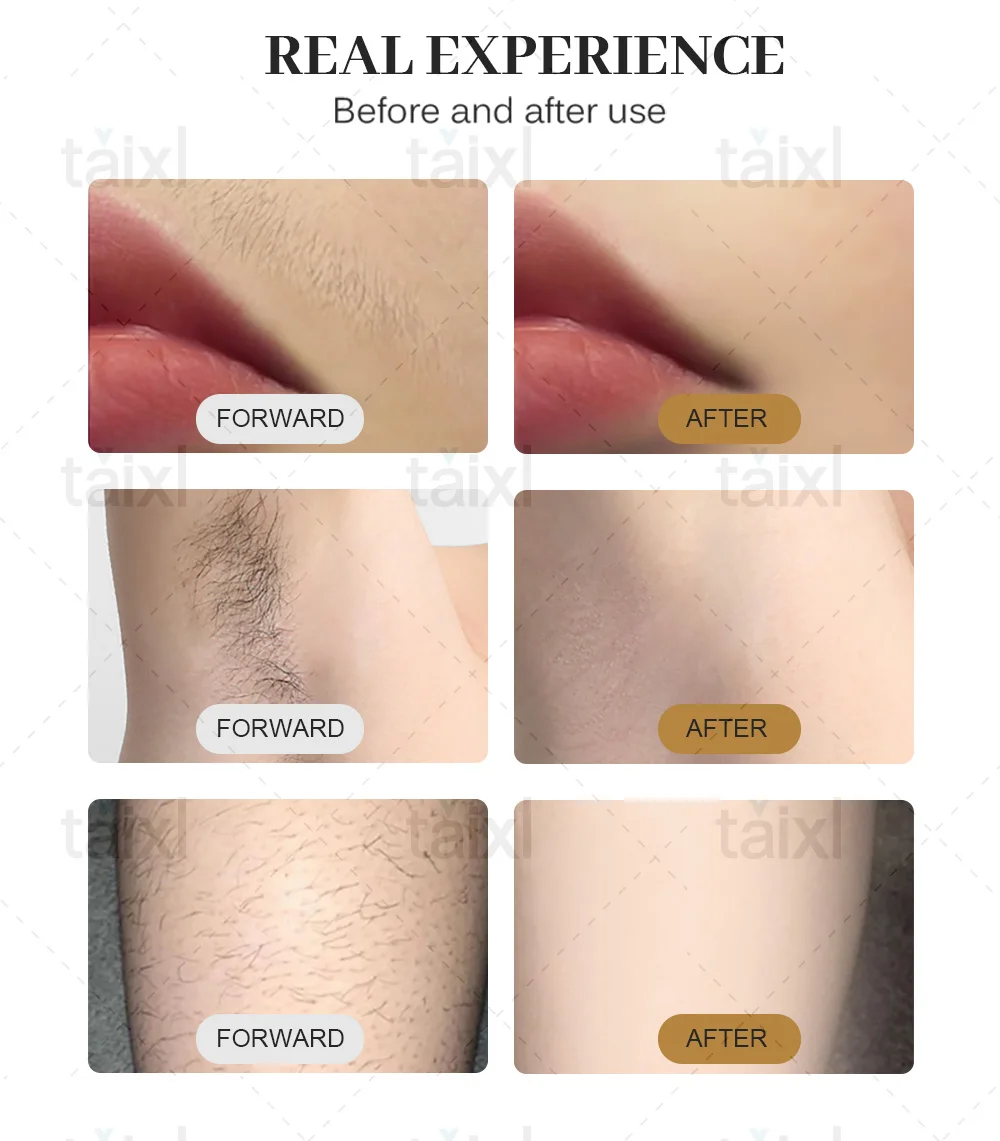 

new professional 808nm laser diode professional hair removal machine 3000W high power 755 808 1064nm Device Ice Platinum