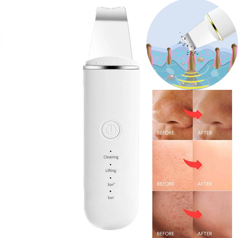 초음파 스킨 스크러버 진동 페이스 주걱 블랙 헤드 리무버 쇼블 클린 캐비테이션 필링 페이셜 리프팅 스킨 케어 도구, 각종 피부 관리
