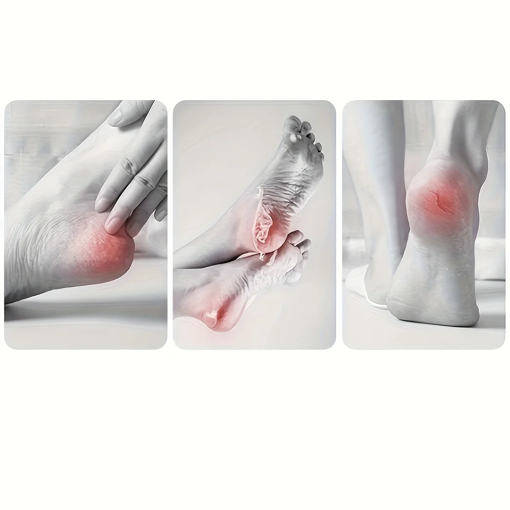 مطحنة القدم الاحترافية المصنوعة من الفولاذ المقاوم للصدأ هي أداة أساسية لإصلاح القدم والعناية بقدرة إزالة بيئة العمل الميتة #6