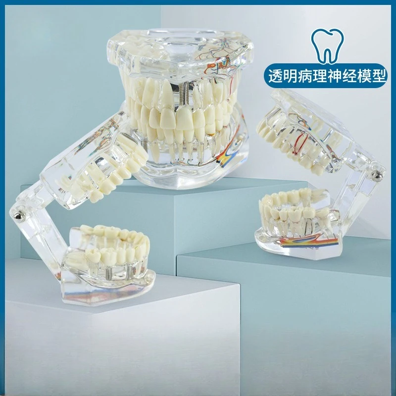Transparent full-mouth pathological tooth model Medical teaching Comprehensive pathological tooth model