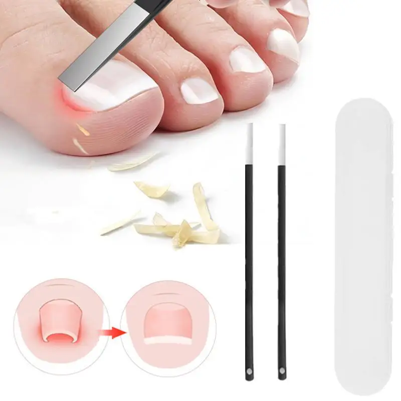 Stainless Steel Ingrown Toenail Correction Tool, Nail Trimming Auxiliary Tool For Men And Women, Essential Foot Tool For Home