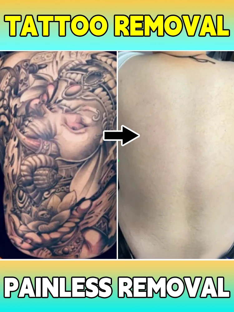 

Immediately lightens tattoos, decomposes pigment particles, and promotes metabolism and shedding
