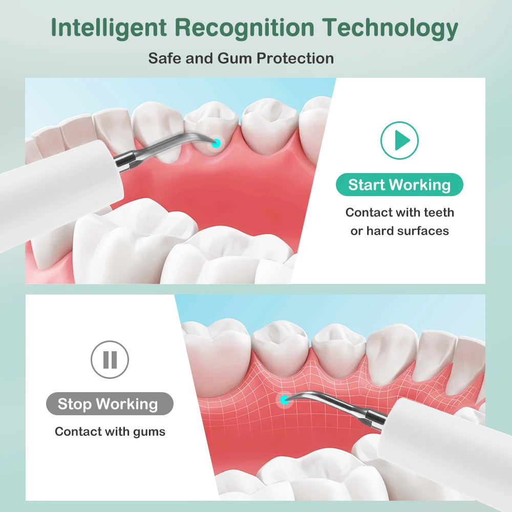 Electric Tooth Cleaner Rechargeable 5 Modes 9 Intensity Levels, Ultrasonic Dental Scaler with 5 Color LED Light for Plaque Remov