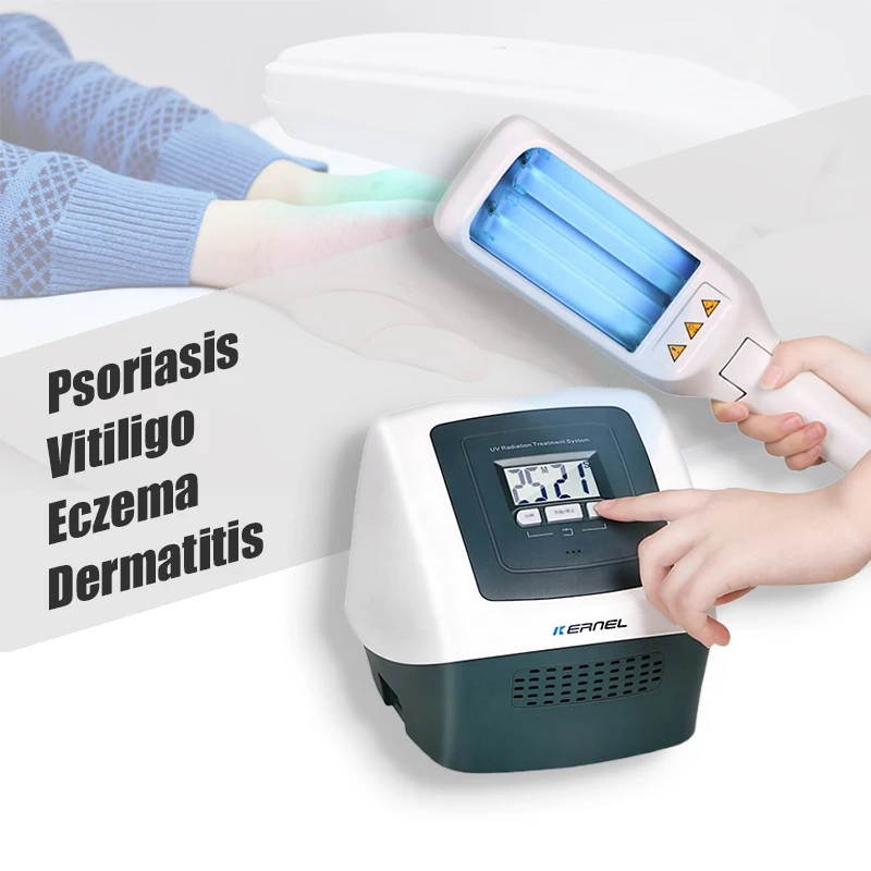 Home use vitiligo medicine Excimer Laser 308nm Psoriasis Vitiligo uvb lamp light therapy for psoriasis treatment