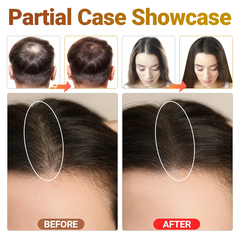 

Advanced Red Light Hair Growth Device Photon Therapy Anti Hair Loss Painless Home Use Strengthen Hair Instrument