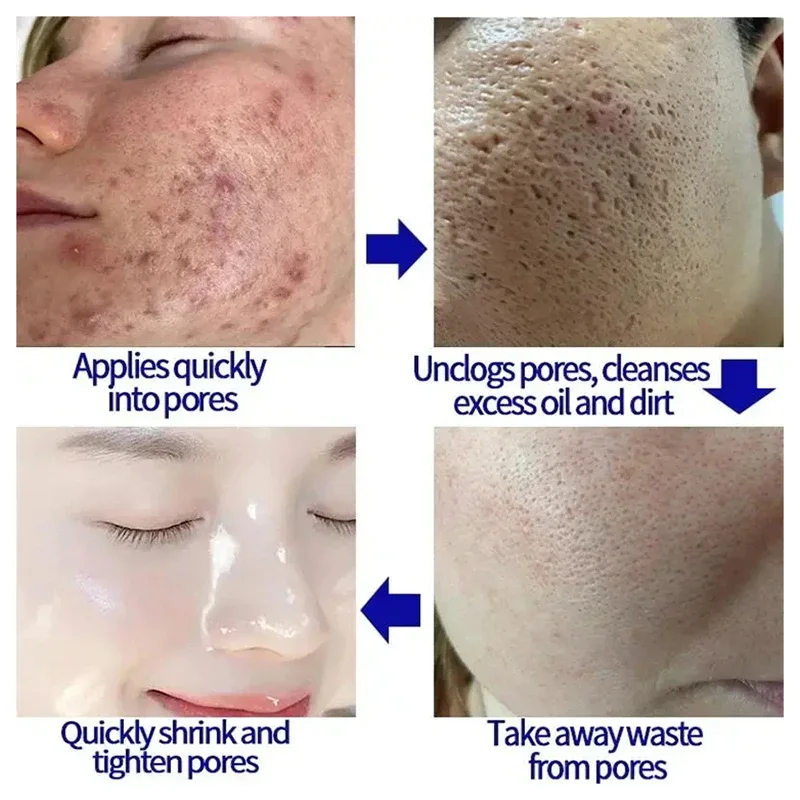 Creme de encolhimento de poros de ácido salicílico elimina poros grandes soro remover cravo acne reparação aperto cuidados com a pele cosméticos