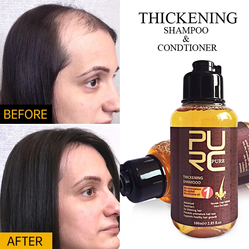 PURC Hair Growth Shampoo Oil Control Anti Dandruff Itching Hair Loss Treatment Fast Regrowth Hair Care Ginger Shampoo