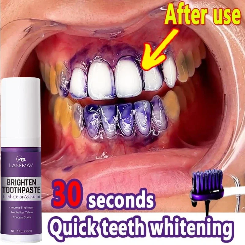 

V34 Teeth Whitening Toothpaste Remove Plaque Stains Cleaning Oral Hygiene Bleaching Dental Tools Fresh Breath Dentistry Care