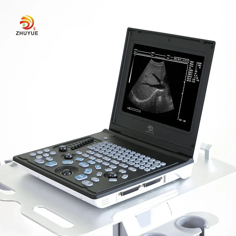 Medical ultrasound instruments Portable Color Doppler Digital Ultrasound Machine Doppler Ultrasonic Diagnostic Ultrasound