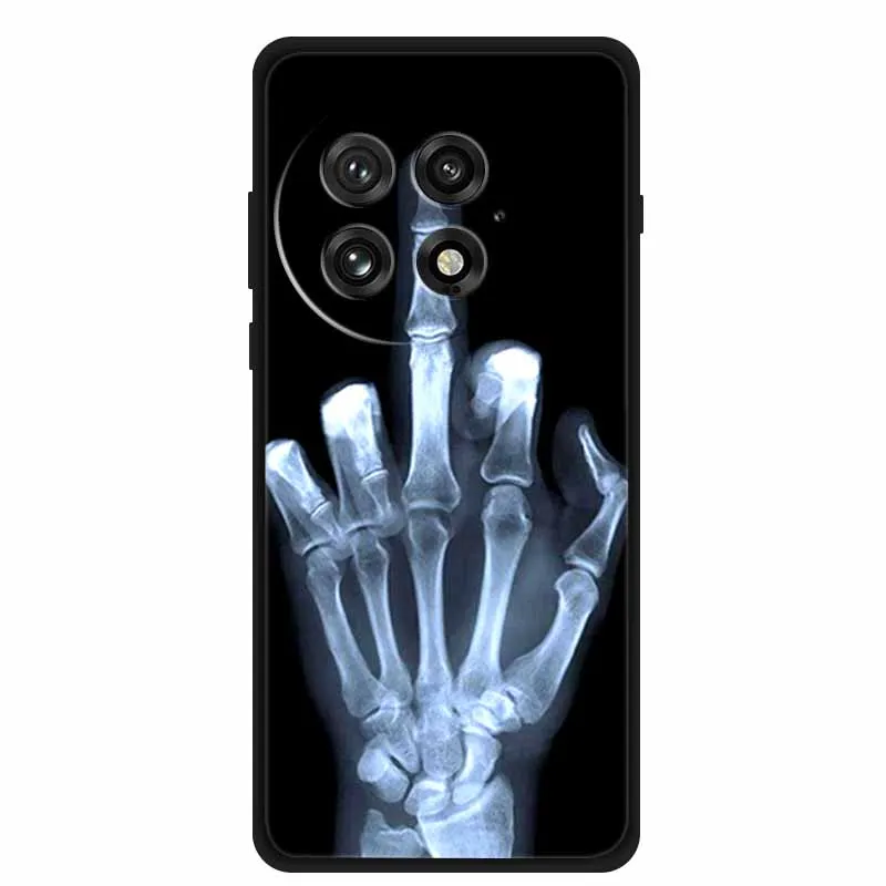 حافظة لهاتف OnePlus ACE 5 PRO مصنوعة من السيليكون الناعم من مادة البولي يوريثان الحراري غطاء خلفي لهاتف OnePlus ACE5 5G Wolf واقي مضاد للصدمات كابا #6