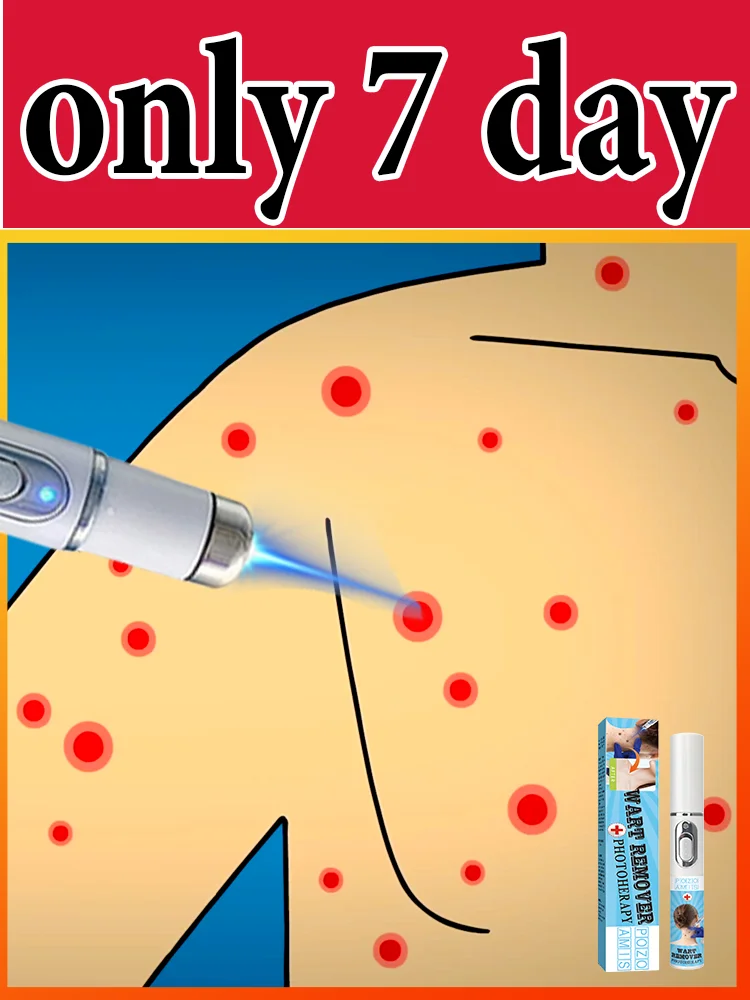 Gᴇɴᴇʀᴀᴛɪᴏɴ-3 Lᴀsᴇʀ Sᴀʏs Gᴏᴏᴅʙʏᴇ Tᴏ Wᴀʀᴛs Iɴ 7 Dᴀʏs