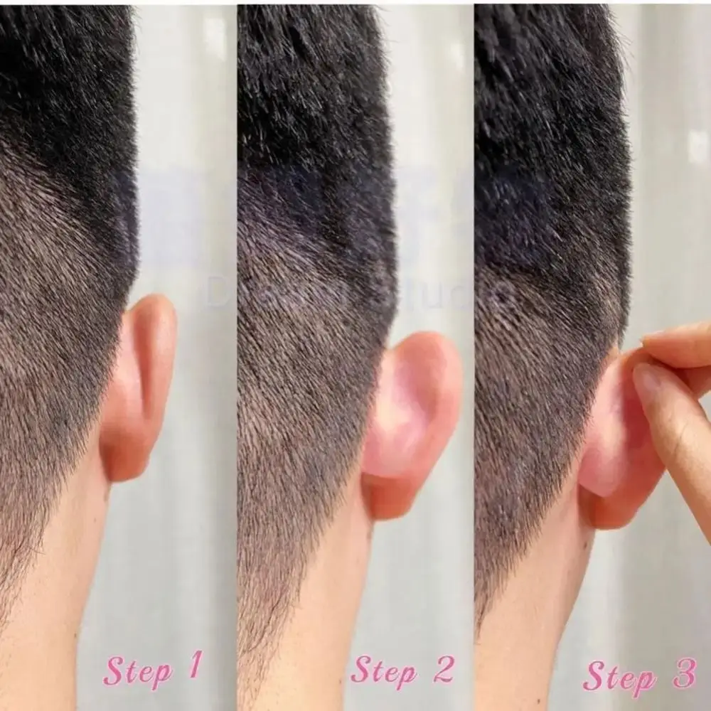 Protruding Ear Solution Invisible Elf Ear Stickers Breathable Transparent Ear Supporters Waterproof Ear Corrector