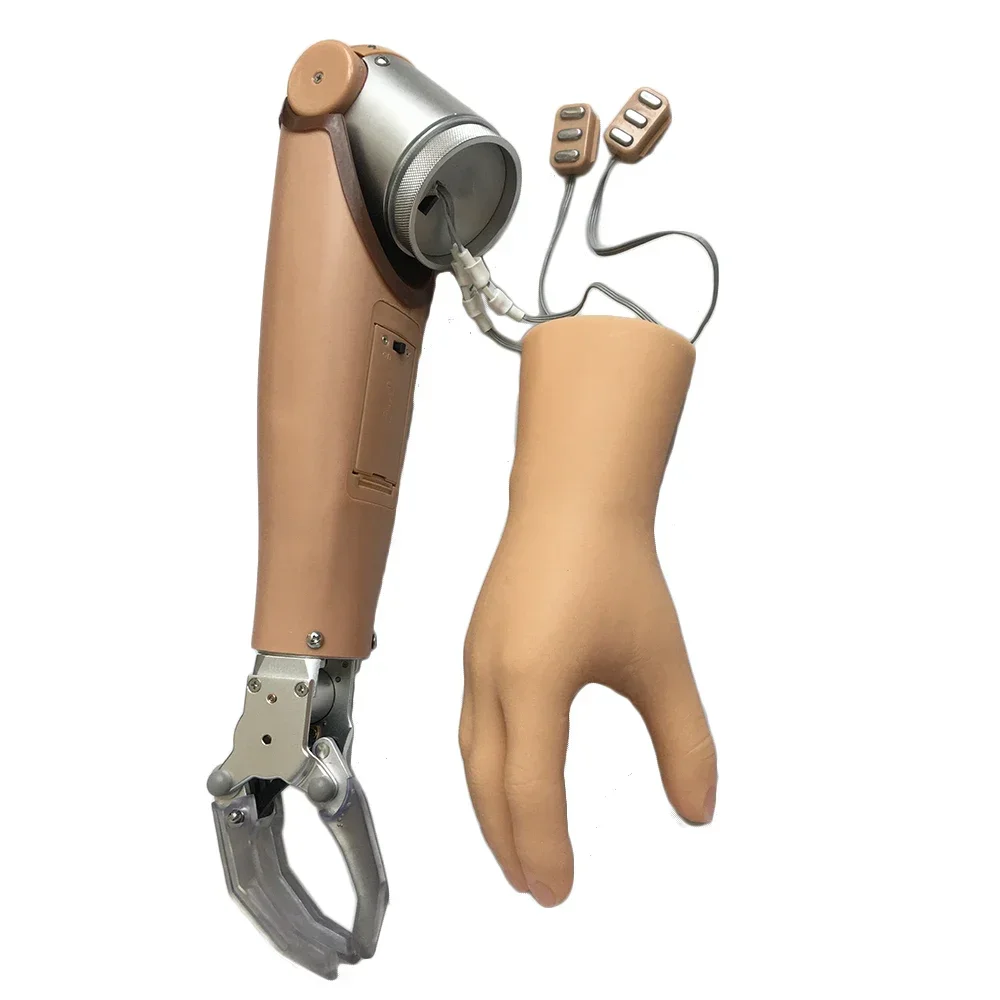 Myoelectric Arm Prostheses With Two Degrees of Freedom for AE Prosthetic Hand