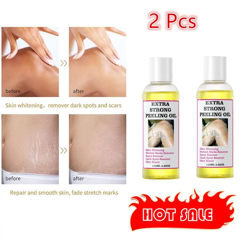 2pcs Exfoliator Cosmetics Yellow Peeling Oil For Dead Skin Removal Exfoliating Facial Strength Peeling Oil Skin Remove Acne