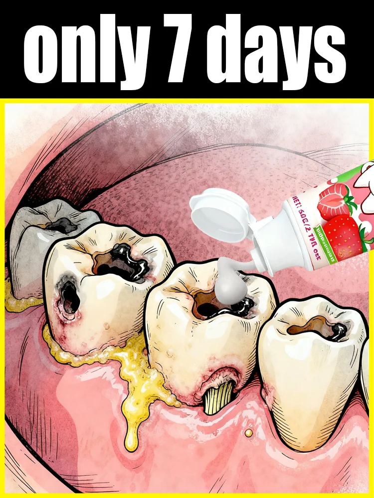 Iɴᴛʀᴀᴏʀᴀʟ Cᴀʀᴇ Tᴏᴏʟ Sᴀʏ ɢᴏᴏᴅʙʏᴇ ᴛᴏ ʏᴇʟʟᴏᴡɪɴɢ ᴏғ ᴛʜᴇ Iɴᴛʀᴀᴏʀᴀʟ ɪɴ 7 ᴅᴀʏs