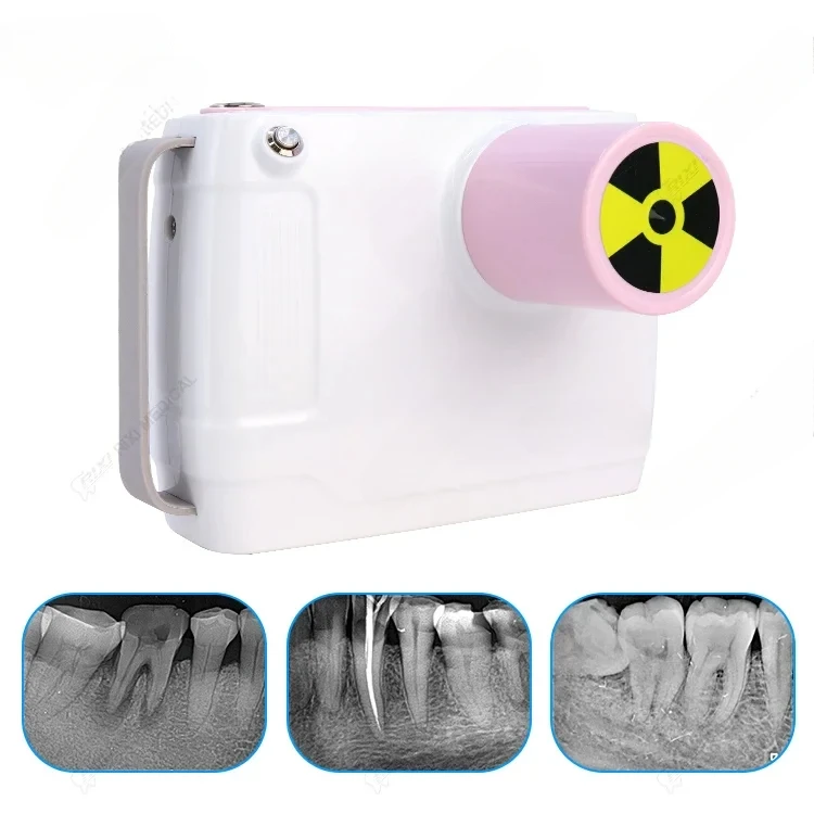 Dentals X-ray cameras/Portables handheld X-ray machines, high-frequency, high-definition, low radiation dentals equipments