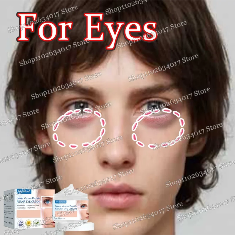 Eye Cream l removes wrinkles, fights sagging and reduces pigmentation