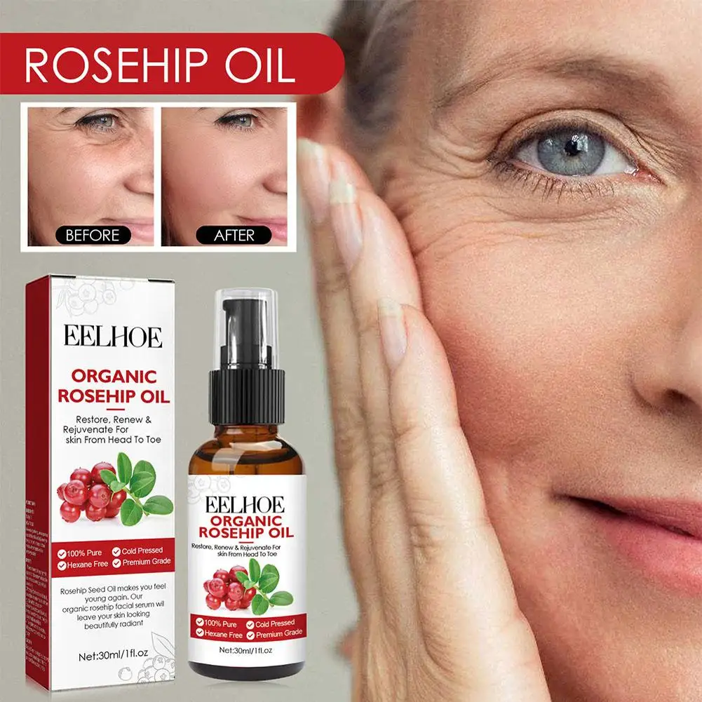 30ml Organic Rosehip Seed Oil For Face Pure Cold Pressed Facial Oil Natural Moisturizing Skin Care Serum