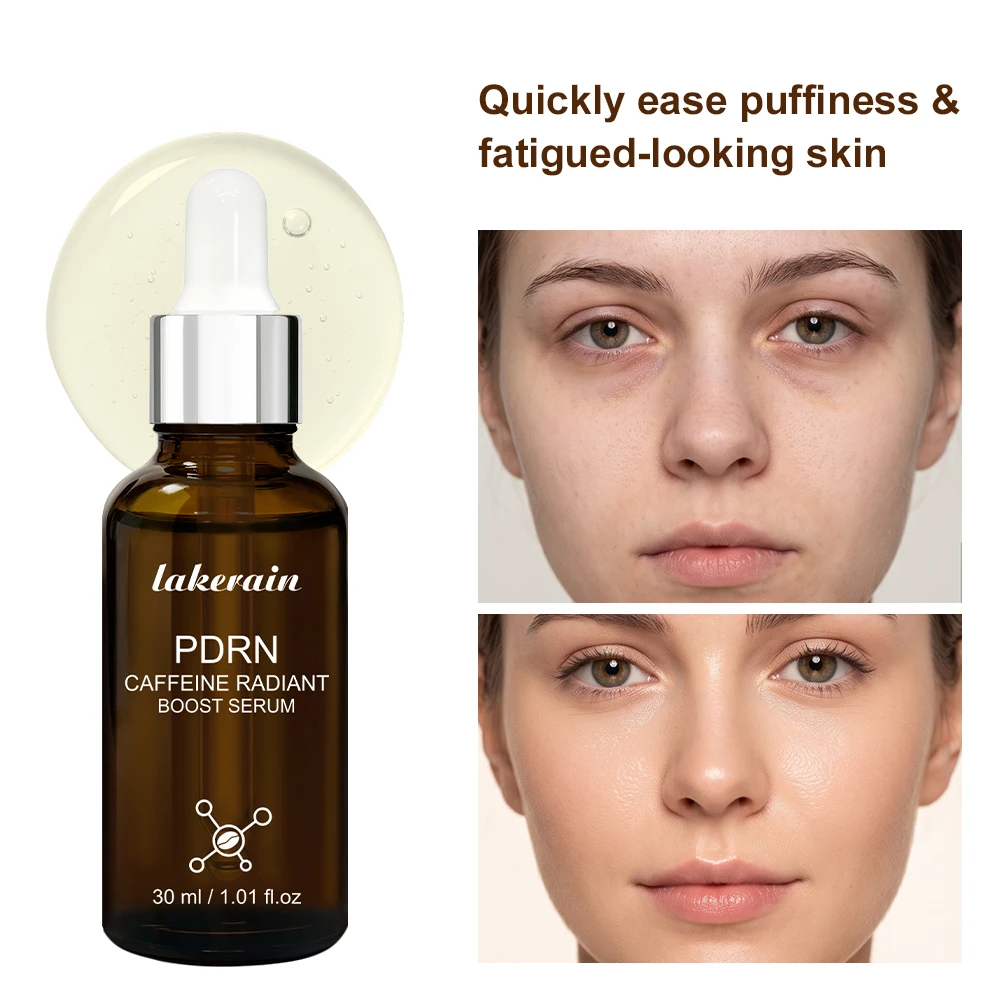 Lakerain BIO-PDRN Caffeine Radiant Boost Facial Serum Morning Rescue Anti Aging Depuff Brightening Repair Serum for Tired Dull S