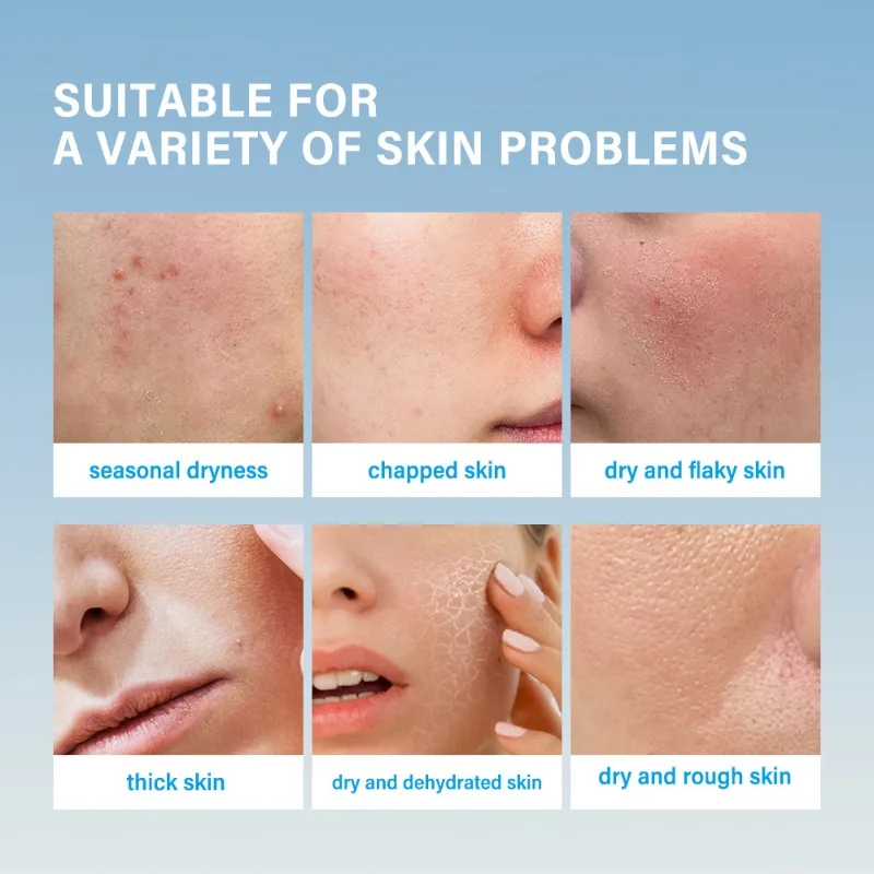 The ideal cream-hydration Cream Instantly in creases skin hydration With Squalane Hyaluronic Acid Niacinamide Facial moisturizer
