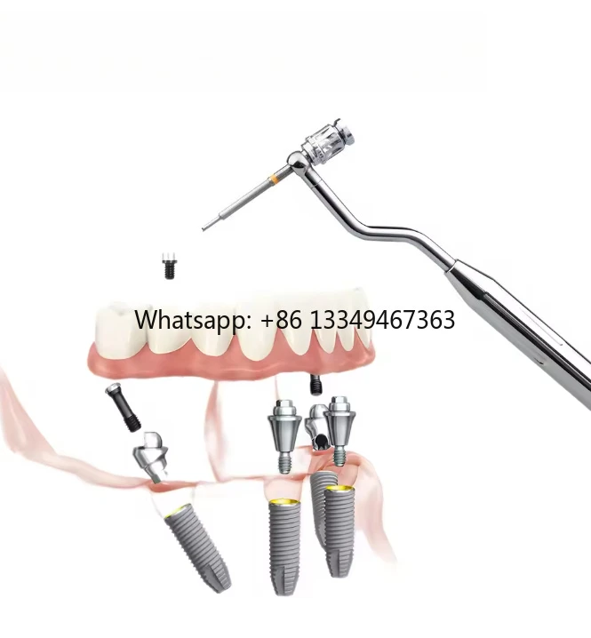 

1 Set Dental Removal Kit, Damaged Screw Extractor Set, Universal Prosthetic Kits For Clinic