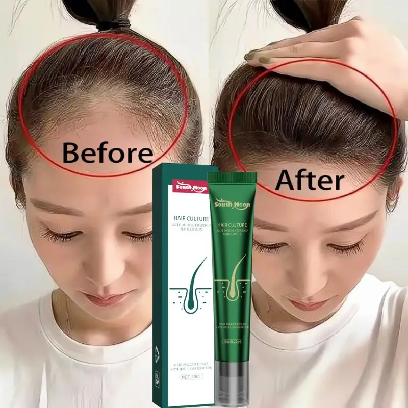 

Fast Hair Growth Serum Anti Hair Loss Essential Oil Prevent Baldness Nourish Scalp Treatment Products Repair Regrowth Hair Care