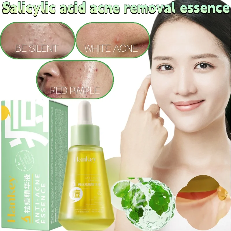 Centella Assai Extract Salicylic Acid Essence Effectively Soothe Skin Redness Contraction Pores and Hydration and Repair Essence