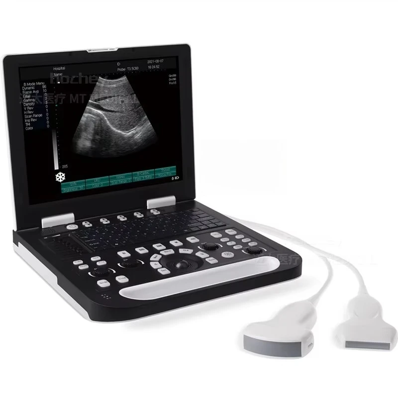 

MT MEDICAL Laptop VET Ultrasound Instruments Portable Ultrasound Scanner Price Animal Ultrasound Machine