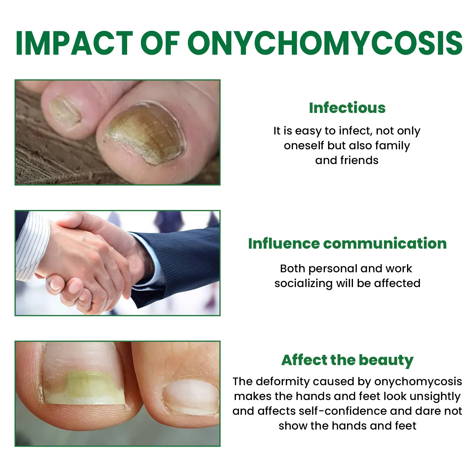 جهاز ليزر فطريات الأظافر علاج الأظافر الفطرية إصلاح فطار أظافر أظافر يزيل باديكير العناية بالقدم الفطريات نام
