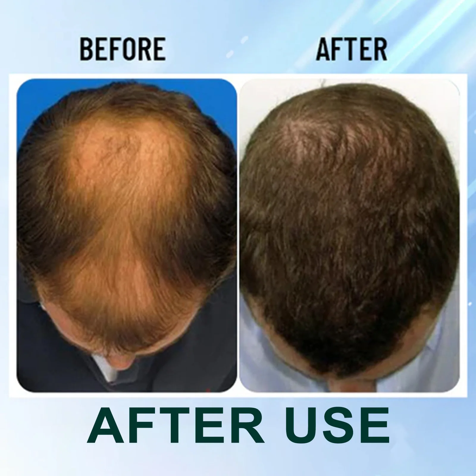 فرشاة تدليك فروة الرأس - فرشاة سميكة بشعيرات الخنزير لتحفيز الجذور ومكافحة تساقط الشعر والعناية بتكثيف الشعر #4