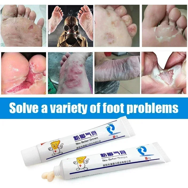 5pcs Remove Odor Anti-itch Beriberi Cream Inhibit Fungi Repair Foot Skin Athlete's Foot Tinea Pedis Ointment Psoriasis 111