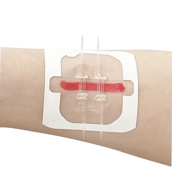 2 torba Fermuar Yara Cilt Kapatma Şeridi PU Pansuman Zip Dikiş Ücretsiz Dikişler Acil Bandaj Yara Kapatma Cihazı Pansuman