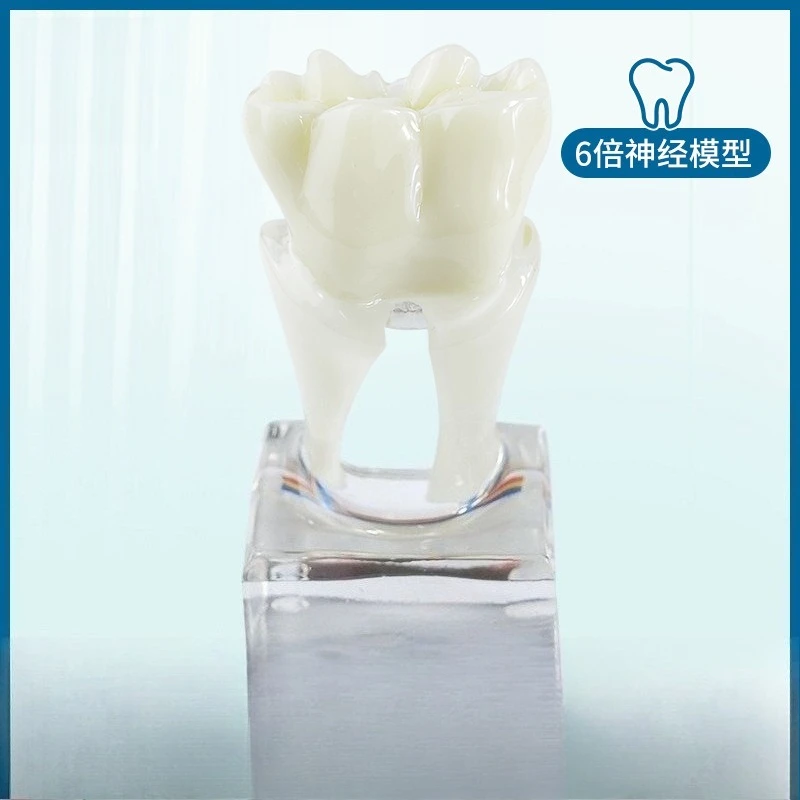Oral 6x nerve line teaching model Tooth decay development demonstration Adult pathological model Tooth display