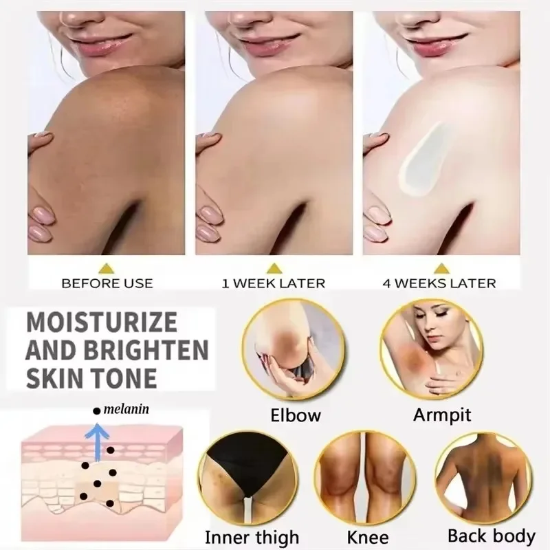 Body Whitening Cream Private Parts Underarm Bleaching Serum Whiten Butt Knee Brighten Inner Thigh Intimate Dark Remove Melanin - Image 5
