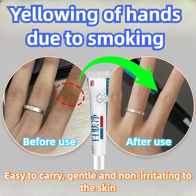 

Yellowing fingers, strong smoke smell, no harm to hands. Remove yellow fingernails, smoke stains, and smoke stains