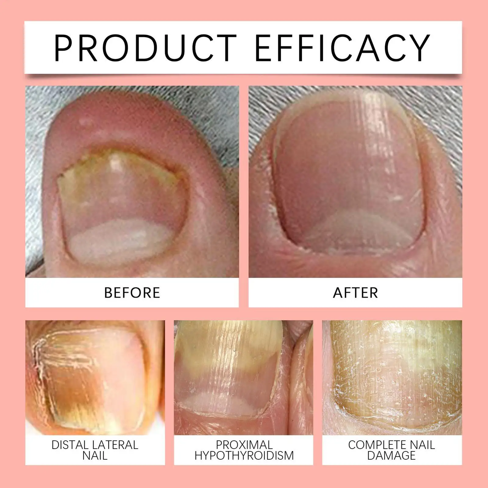 爪修復パッチ 夜間足爪再生パッチ 21 枚 健康的な外観を回復 爪の成長を改善 強化