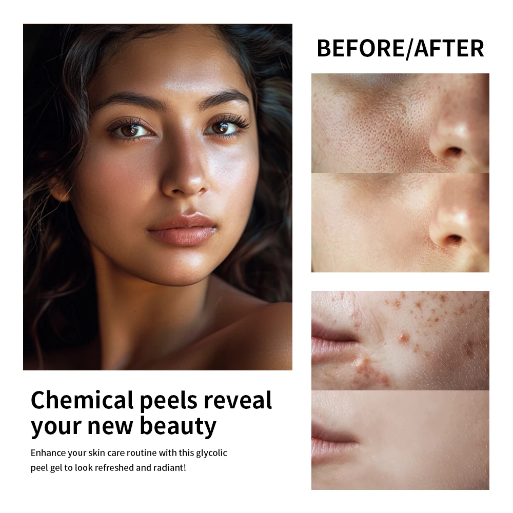 30% グリコール酸フェイスケアローション保湿コントロールオ - Lactic Acid Toner のレビューと価格