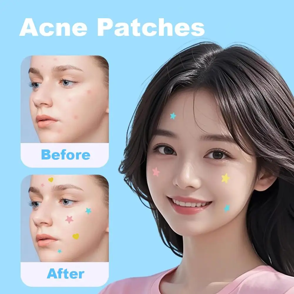 Hydrocolloid Acne Patch Concealer Patch Fade Acne Blackheads And Closed Waterproof Breathable Acne Skin Patch Makeup Tool