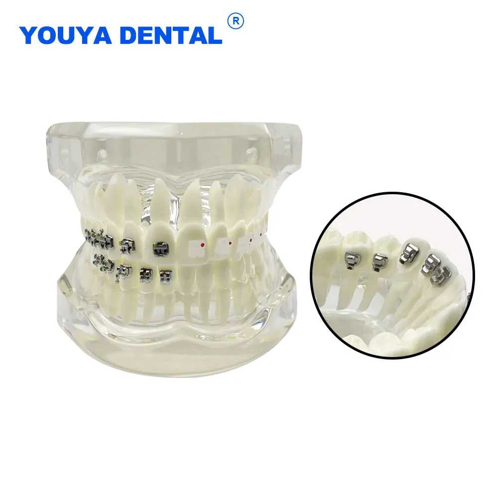 With 4 kinds Brackets Dental Orthodontic Model Metal Self-ligating bracket Ligating Braces Standard Demo Resin Comparison Model