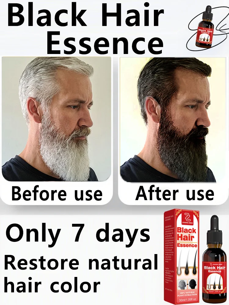 

Vegan Anti Gray Hair Serum - Reverse Gray & Restore Dark Shiny Hair | Prevent Early Graying + Youthful Shine | Fast Results