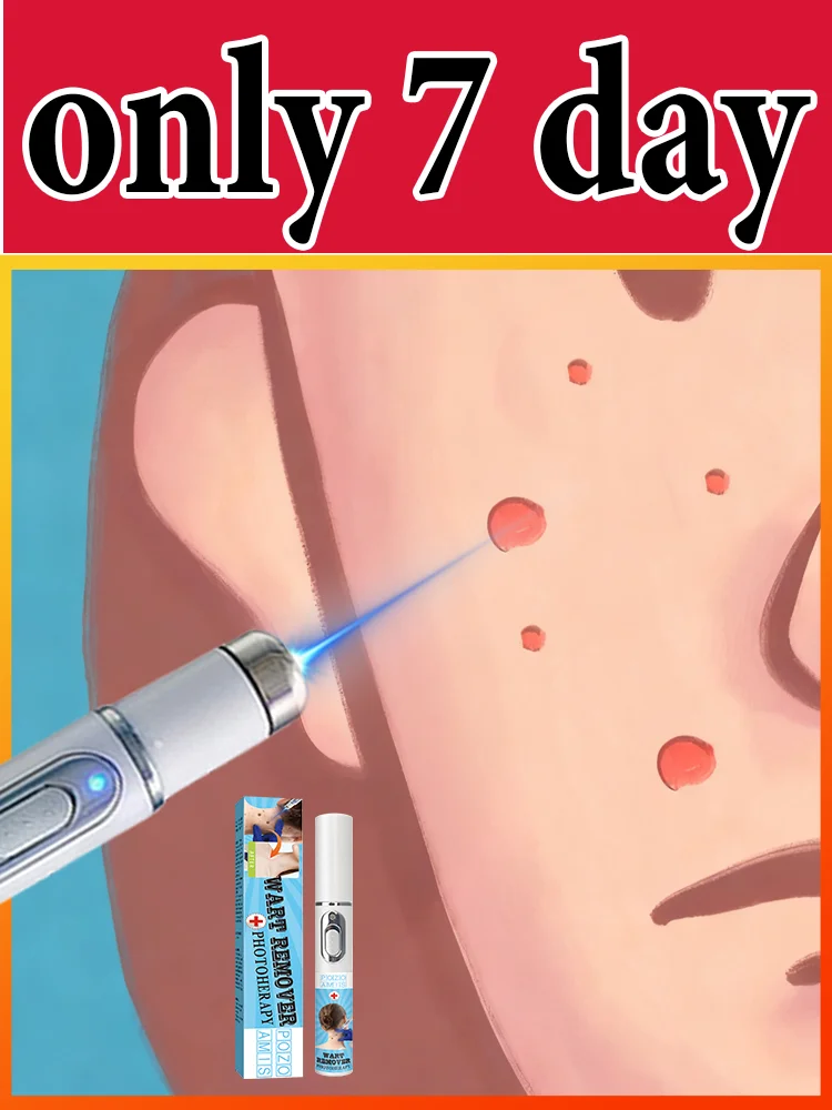 Gᴇɴᴇʀᴀᴛɪᴏɴ-3 Lᴀsᴇʀ Sᴀʏs Gᴏᴏᴅʙʏᴇ Tᴏ Wᴀʀᴛs Iɴ 7 Dᴀʏs