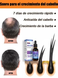 Producto superventas, el 99% de los compradores vuelve a comprar, tiene más y más cabello, Di adiós a la calvicie, cabello grueso