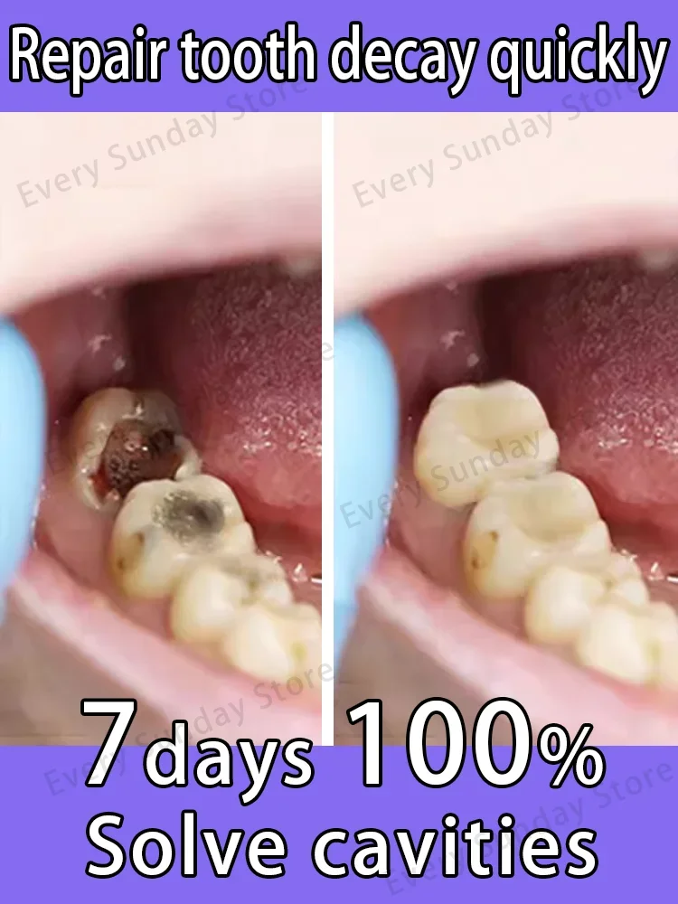 Hot selling product, 99% of buyers buy again,Teeth are getting better