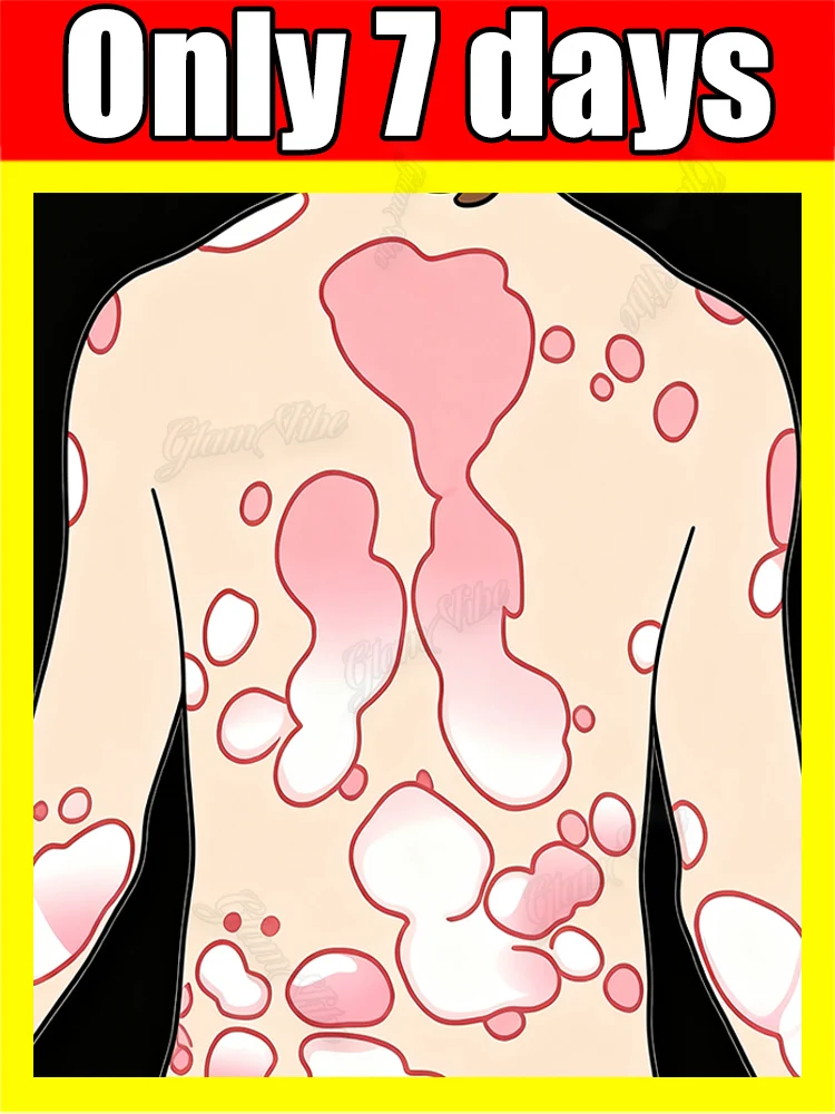 

Твторое поколение делает кожу ис